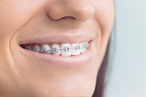 Best Traditional Braces  in Covington, GA